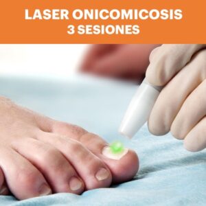 LASER ONICOMICOSIS 3 SESIONES